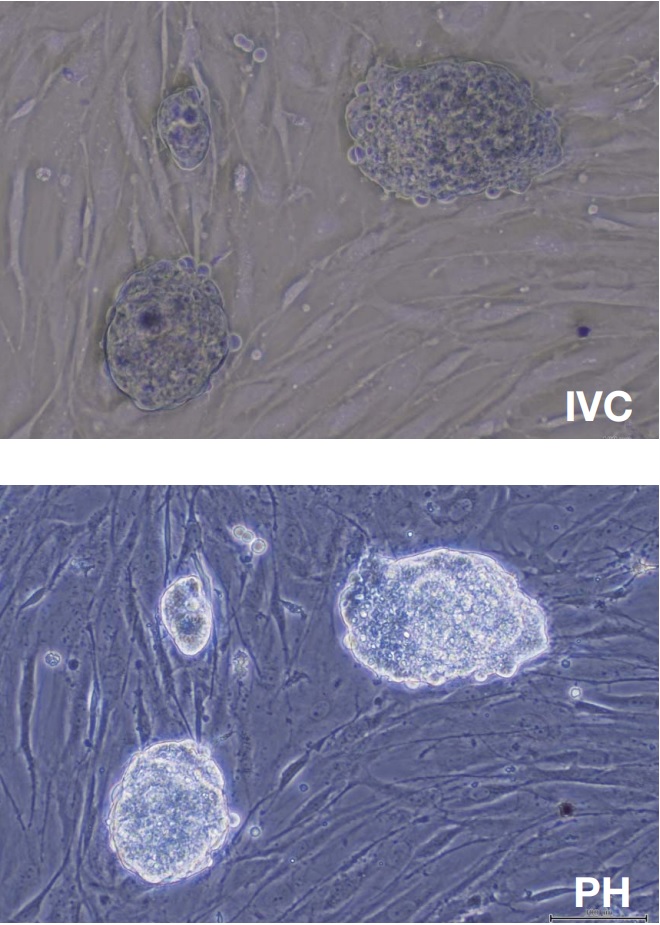 Inversion contrast (IVC)