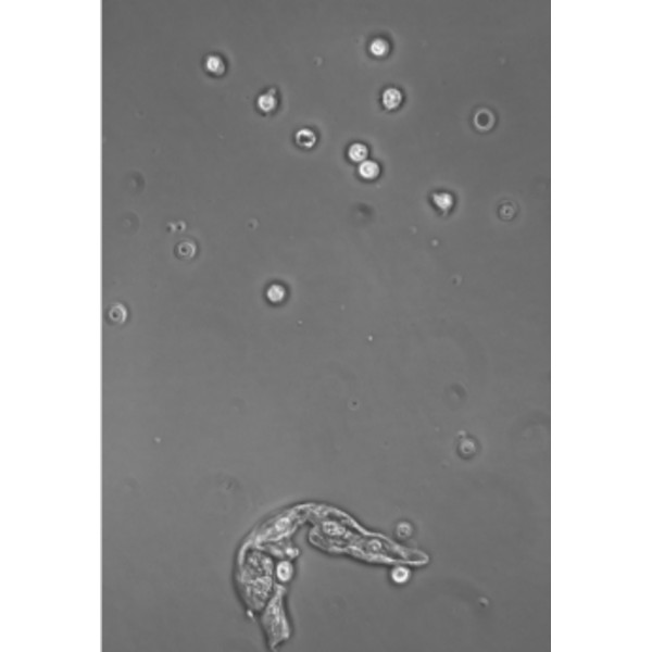 Hund Microscope Medicus PH Plan, trino, 100x-1000x