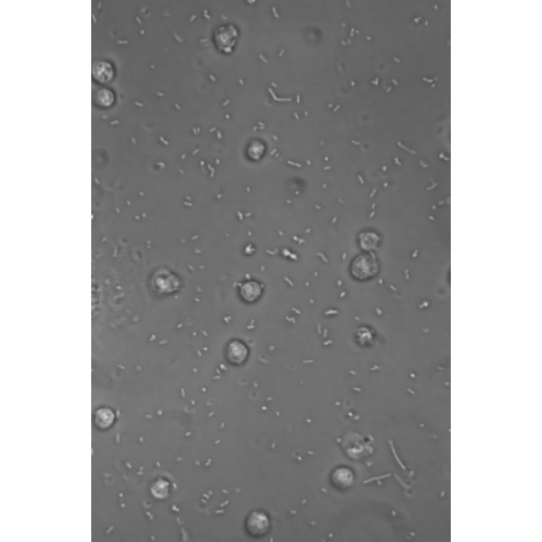 Hund Microscope Medicus PH Plan, trino, 100x-1000x