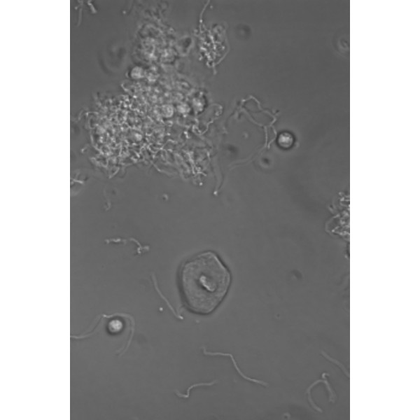 Hund Microscope Medicus PH Plan, trino, 100x-1000x