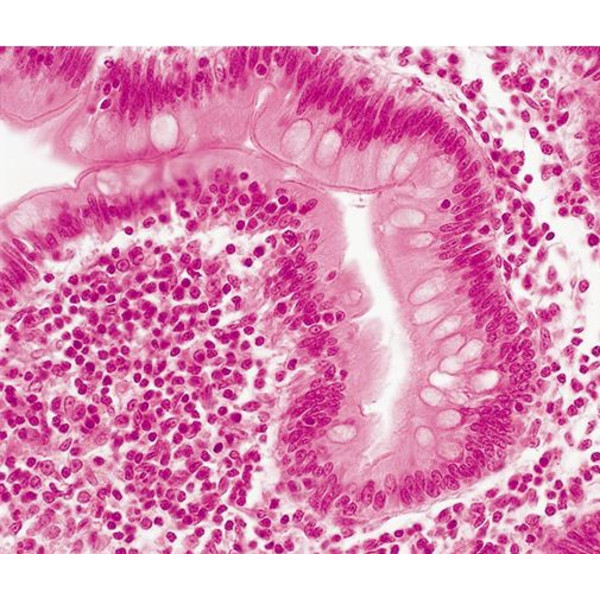 Evident Olympus Microscope CX31 bino, Hal, 40x,100x, 400x