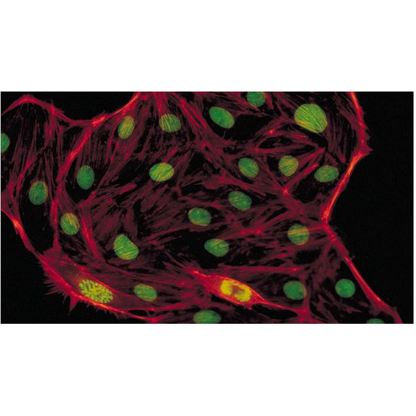 Evident Olympus Microscope CX41 fluorescence, trino, 40x,100x, 400x