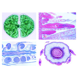 LIEDER Cryptogamae, supplementary set II, 25 microscope slides