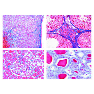 LIEDER Sec. School, Set No. IV. Hormone Organs and Hormonal Functions, 7 microscope slides