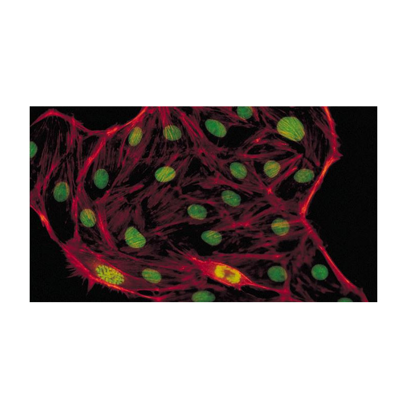 Evident Olympus Microscope CX41 fluorescence, trino, 40x,100x, 400x