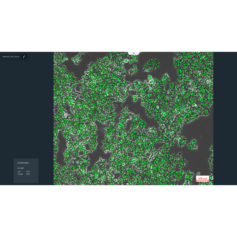ZEISS software Labscope AI Cell Counting DLic module